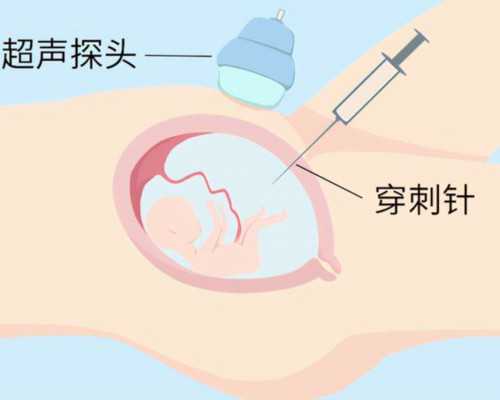 上海借卵子,上海试管婴儿全记录之定移植时间啦