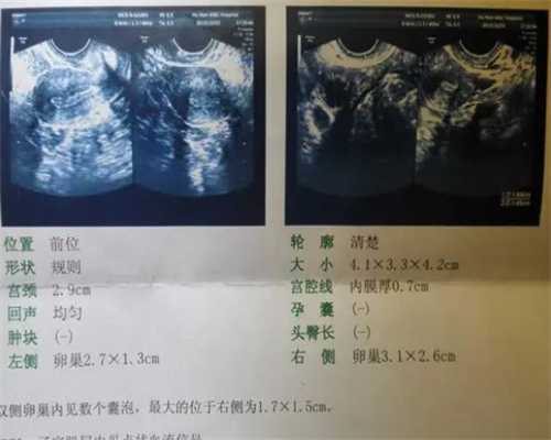 上海代孕包成功公司,试管打促排卵针肚子涨怎么办-上海供卵试管双胞胎-上海供